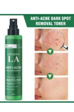 Uptown LA Women's Anti-Acne Face Toner