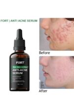 FORT Salicylic Acid Serum – Anti-Acne Face Serum